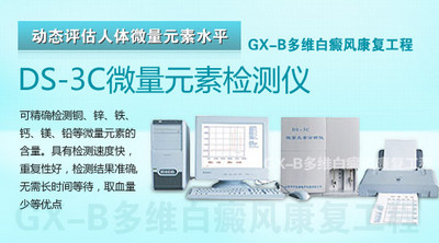 白癜风有什么特点